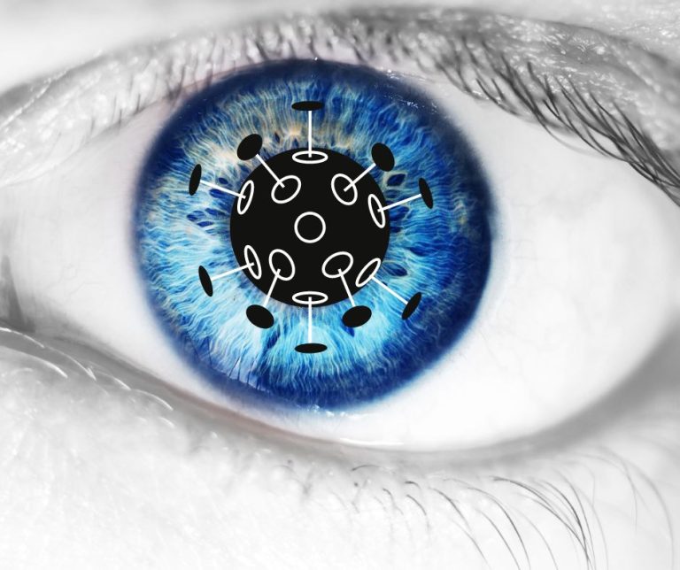 Keep an eye out for mould